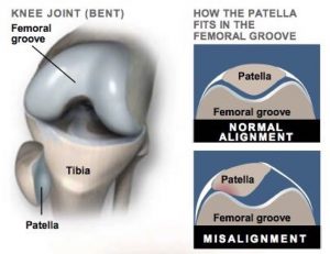 Knee Joint Diagram